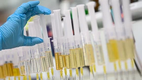 SPD will Rente für DDR-Dopinggeschädigte