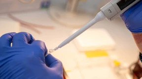 Hilfe bei seltenen Krankheiten