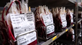 Planbare Operationen besser vorbereiten