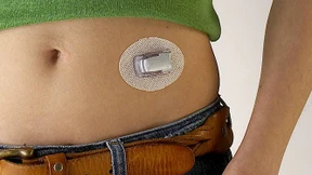 Wenn IT-Einbrecher lebenswichtige Medizingeräte entern 