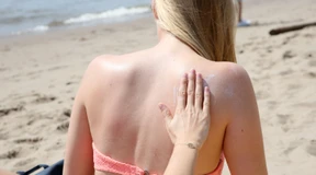 Sommer, Sonne – Hautkrebs?