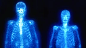 Die Vermessung des Körpers