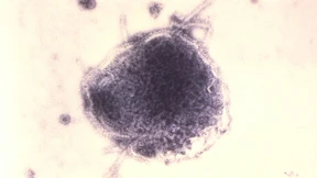 Jede Stunde sterben 14 Kinder 