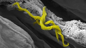 „Als bekämen Sie für Ihren Rechner keine Updates mehr“