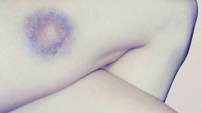 Was Frauen über häusliche Gewalt wissen müssen