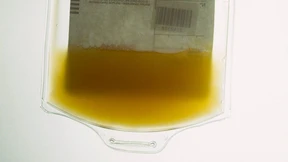 Lebenselixier vom Tropf