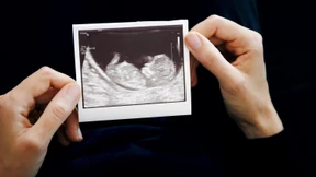 Was hilft bei häufigen Fehlgeburten?