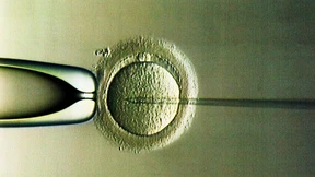 Ist das Y-Chromosom überflüssig? 