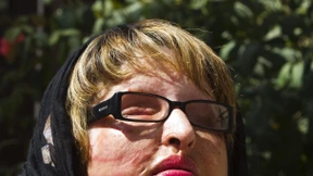 Doch nicht Auge um Auge