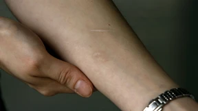 Selbstverletzung und  chronische Leiden