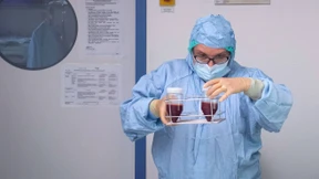 Weniger Spender für Stammzellen