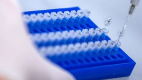 Humanes Circovirus verursacht eine Leberentzündung