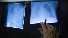 „Beweisen können wir den Missbrauch selten“