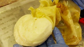 Kokain in Brustimplantaten geschmuggelt