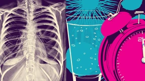 Wie Fasten und spezielle Diäten bei der Krebstherapie helfen könnten