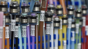 Die wichtigsten Antworten zum schnellen Internet in Deutschland