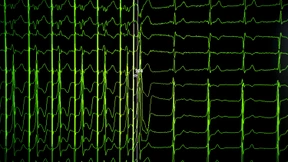 „Der Klimawandel verändert unsere medizinische Realität“