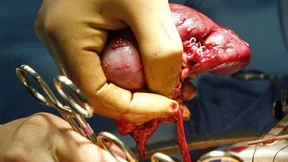 Im Transplantationsskandal gibt es viele Täter