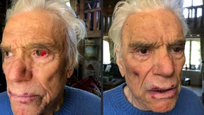 Brutaler Einbruch bei französischem Manager Tapie