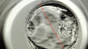 Wir pellen Eizellen aus der Haut