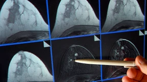 Das Glück ist mit den Gen-Getesteten