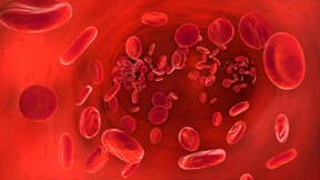 So halten Sie Ihre Blutgefäße elastisch