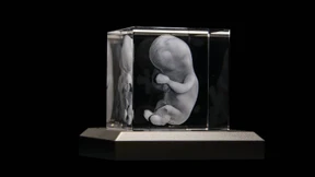 Erst das Werbeverbot, dann die Abtreibung?