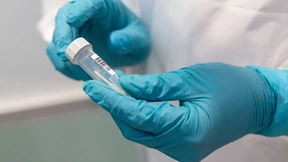 Steigt die Kurve nur, weil Labore mehr testen?