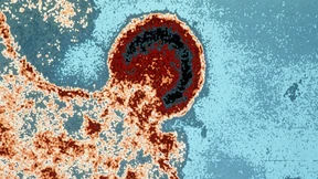 Unser Leben mit Aids