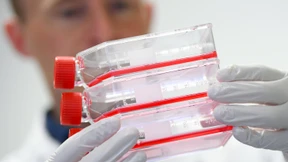 25 Neuinfektionen und zwei Tote in Hessen