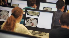 Ankreuzen, wenn es weh tut