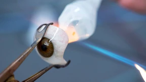 Wie Glasaugen gemacht werden