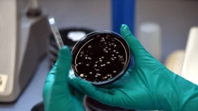 19 Menschen sterben bei großem Legionellenausbruch