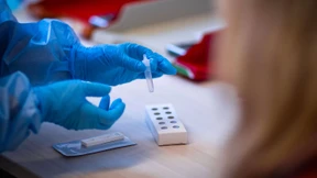 Robert Koch-Institut sieht Beginn der vierten Pandemie-Welle