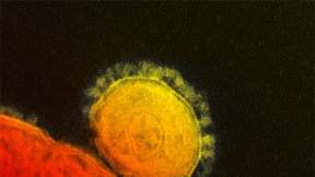 Wie sich die Sars-Viren voneinander unterscheiden