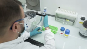 Warum Pharma-Werte an den Börsen straucheln