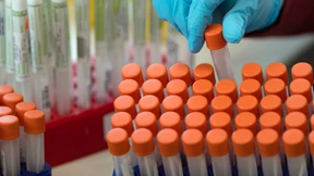 RKI meldet mehr als 1700 Infektionen