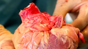 Manipulation der Warteliste: Klinik weist Vorwürfe  zurück