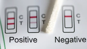 Zahl der Corona-Infektionen steigt wieder an