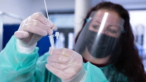 Anteil von Omikron-Linie BA.5 nimmt weiter ab