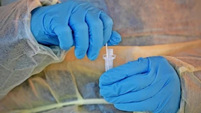 Inzidenz steigt leicht auf 1174,1