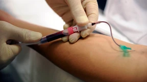 Die Kartierung der Schizophrenie 