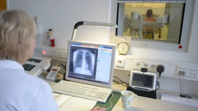 Mehr Tuberkulose-Kranke in Deutschland