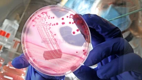 Führte Zwiebelmettwurst zu einem EHEC-Ausbruch?