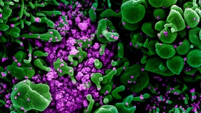 Wohin driftet die Pandemie?