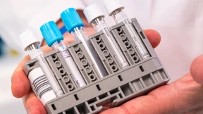 „Wir sind am absoluten Limit“