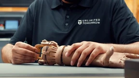 Erfinder schafft günstige und individualisierte Prothesen