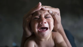 Wie viel Übertreibung steckt in der Zika-Epidemie?