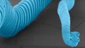 Der Tumor aus dem Wurm