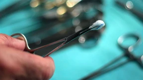 Braucht die Beschneidungs-Debatte ein Update?